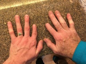 coincidental hand comparisons